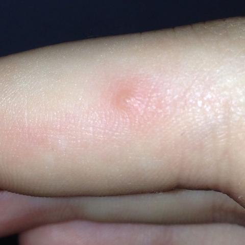 View Pickel Mit Hartem Kern Video Pictures