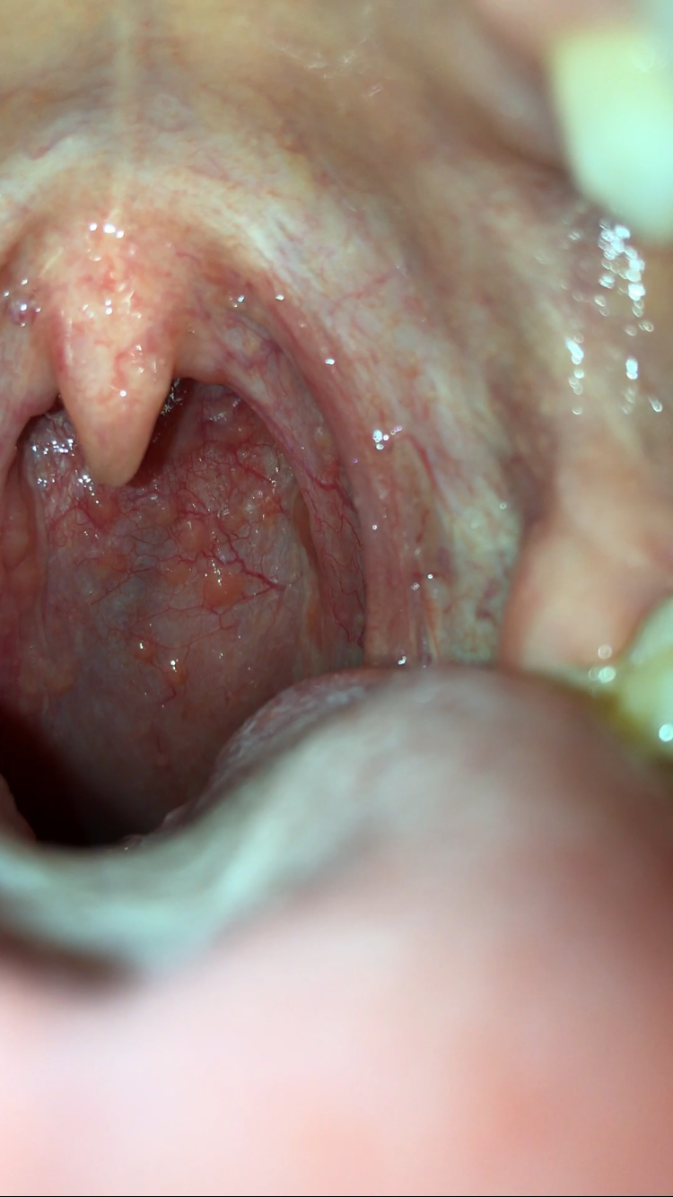 pickel an der schl�fe