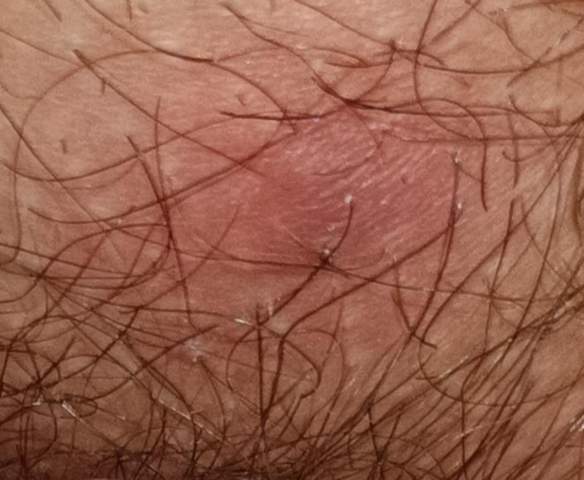 Bild zum Beitrag