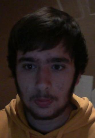 Pickel Seit Ich Bart Wachsen Lasse Pubertat