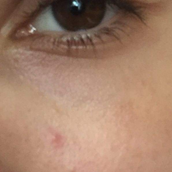 Pickel unter Auge? (Beauty, Augen)