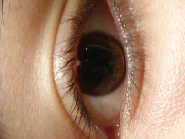 Auge - (Augen, Augenlid)