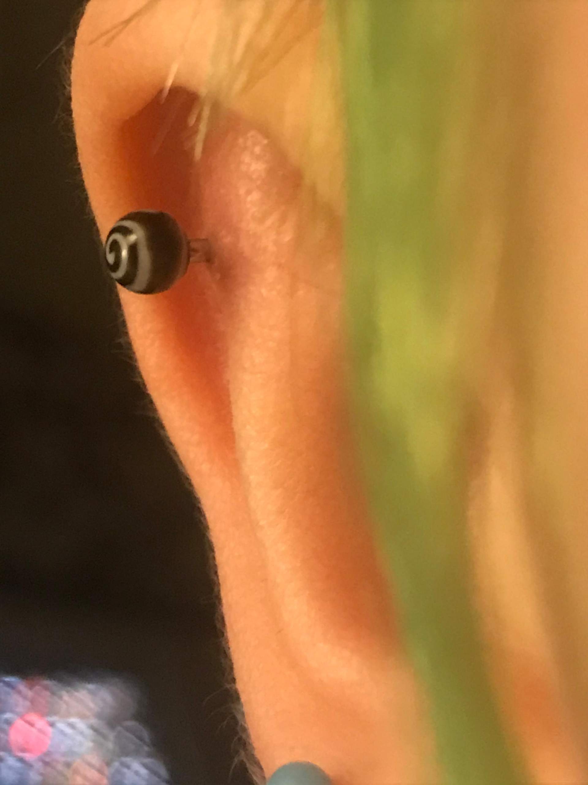 Piercing entzündet oder sogar wildfleisch? (Gesundheit und Medizin