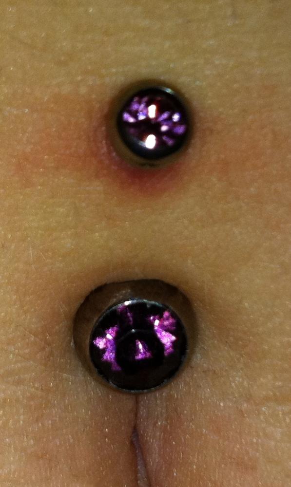 Rumination Focused Cognitive Behavioral