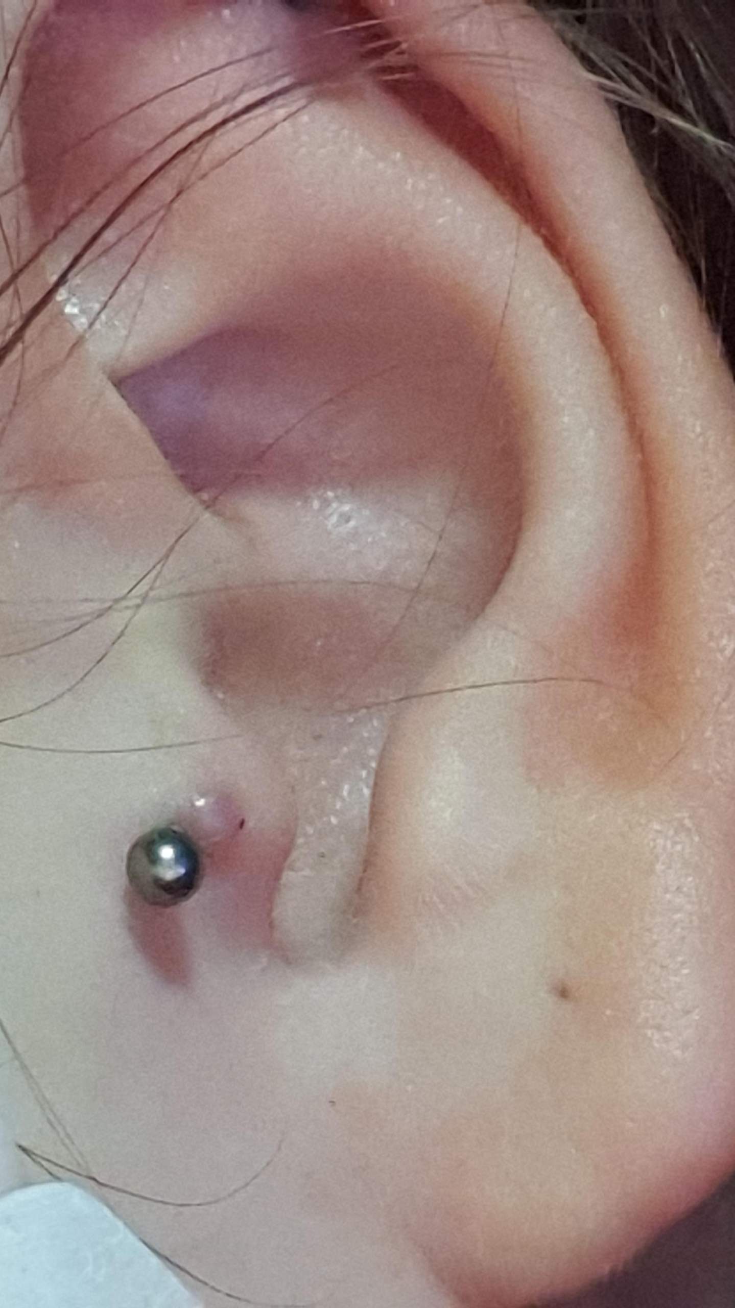 piercing hubbel angst piercer entzundet