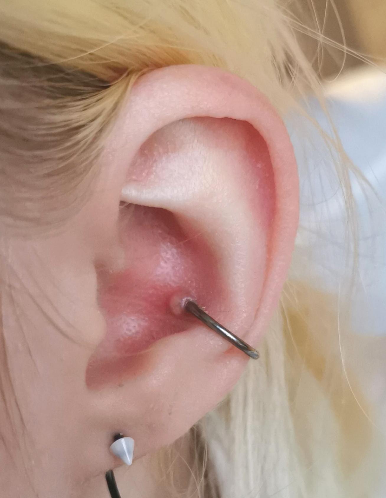 Was Tun Gegen Wildfleisch Am Bauchnabelpiercing