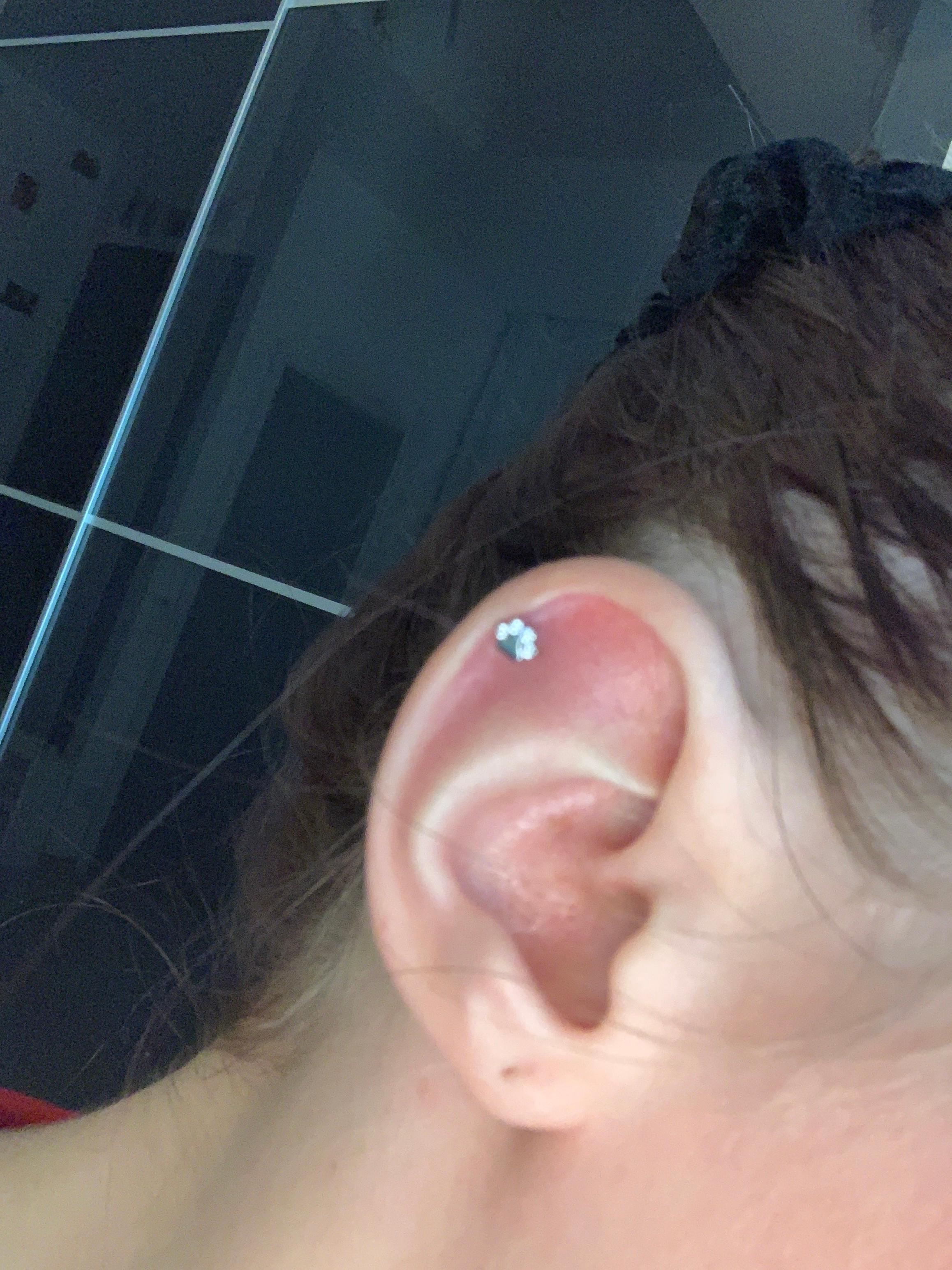 Piercing Vor 7 Monaten Entzundet Gesundheit Und Medizin Helix Piercer