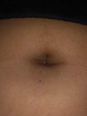 Erfahrungen und Vorgehensweise beim selbst Stechen eines Bauchnabelpiercings Erfahrungen und Vorgehensweise beim selbst Stechen eines Bauchnabelpiercings