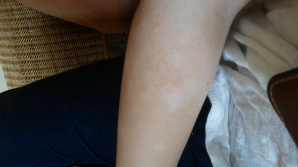 - (Arzt, Haut, krank)
