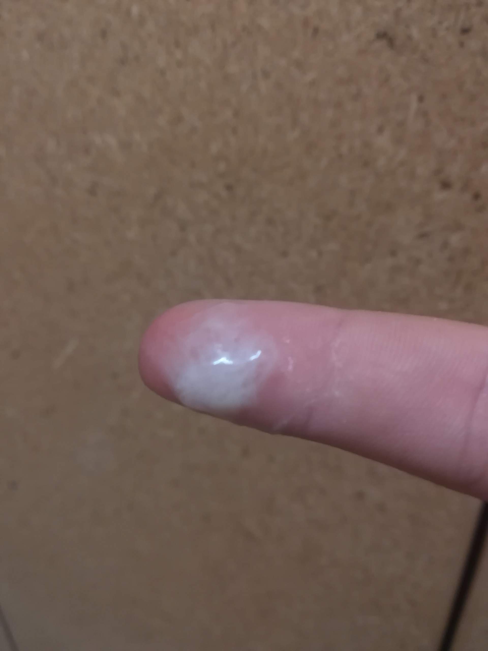 Pille Danach Gewirk Zervixschleim Sex Schwangerschaft Pille Danach Gewirk Zervixschleim Sex Schwangerschaft