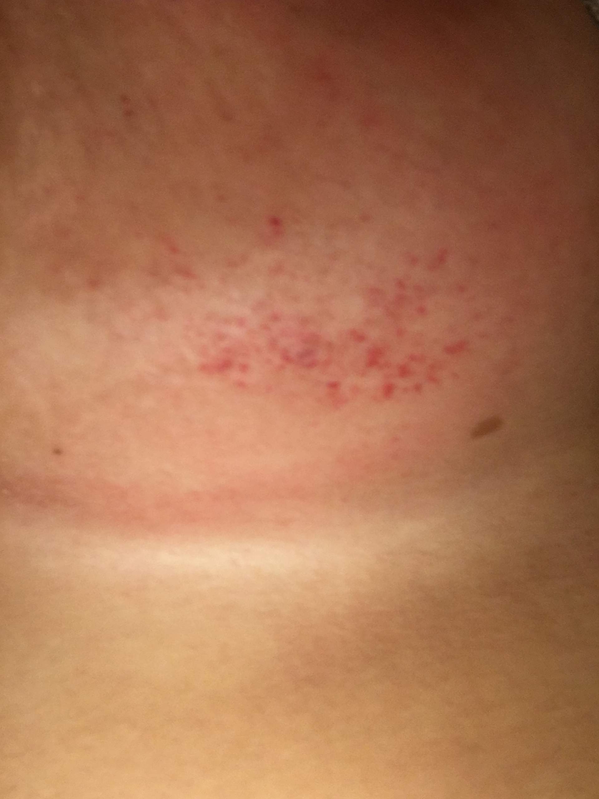 Wie Bekommt Man Wimpernkleber Von Der Haut Ab