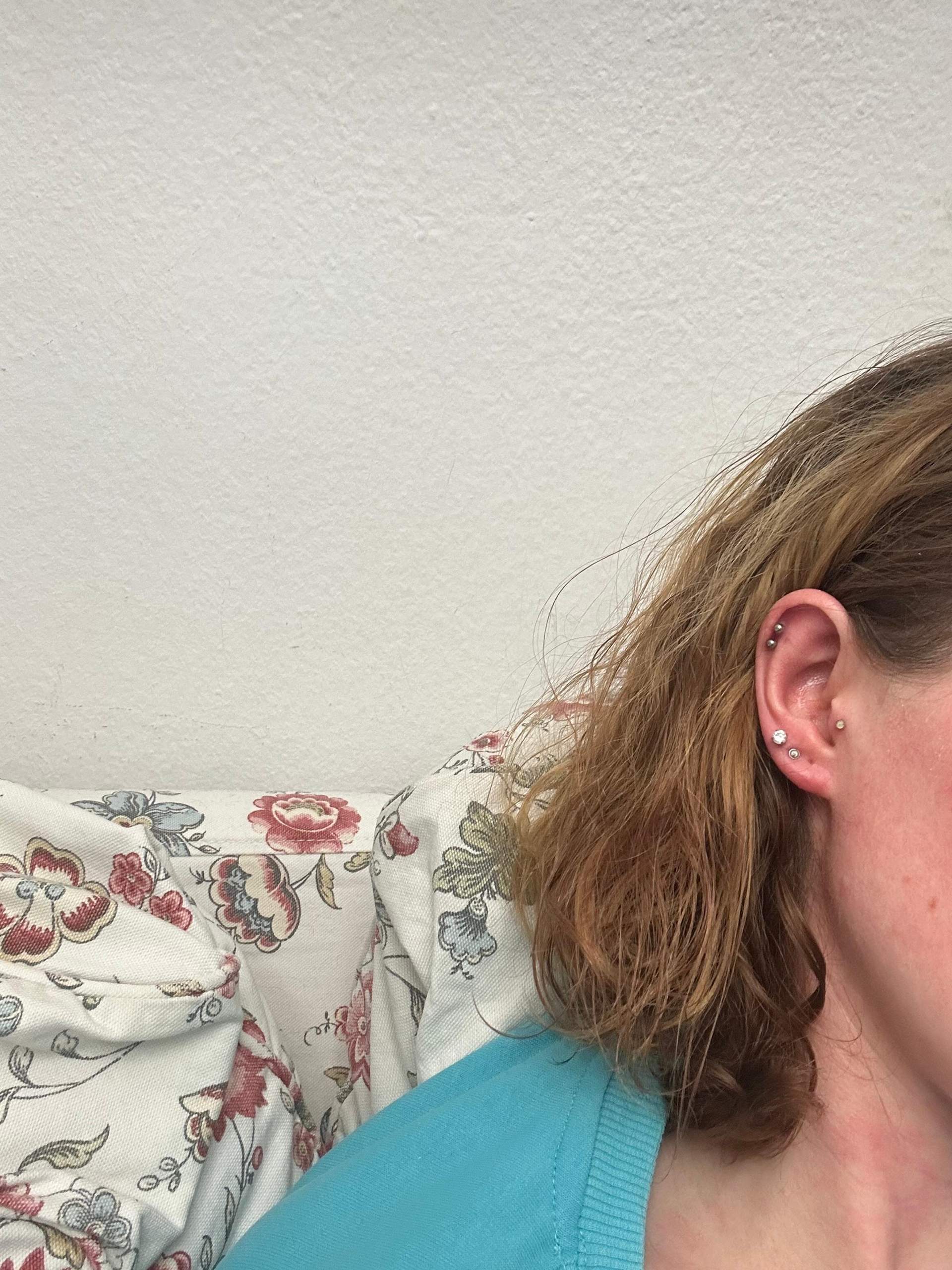Pircing rot? (Piercing, Entzündung, Piercingschmuck)