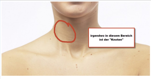 Plötzlich aufgetretener Schmerz im Hals vorne rechts? (Gesundheit und Medizin, Schilddrüse ...