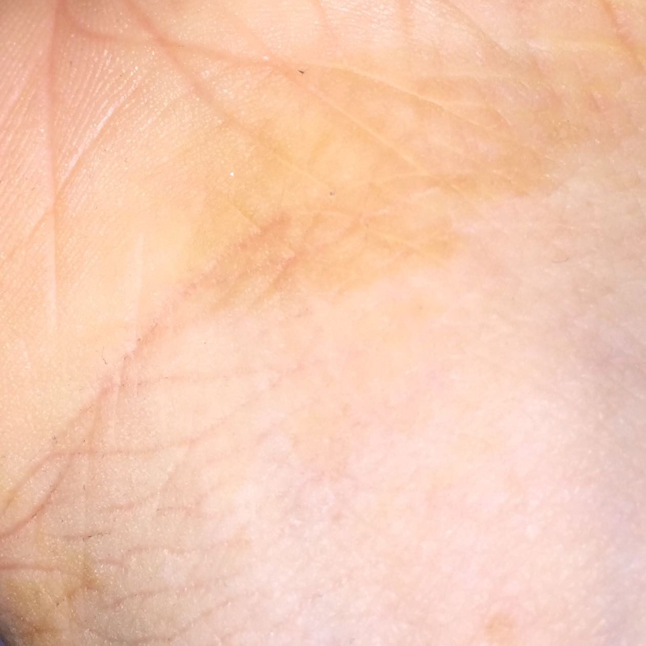 Plötzlich gelbe Flecken? (Gesundheit und Medizin, Gesundheit, Menschen)