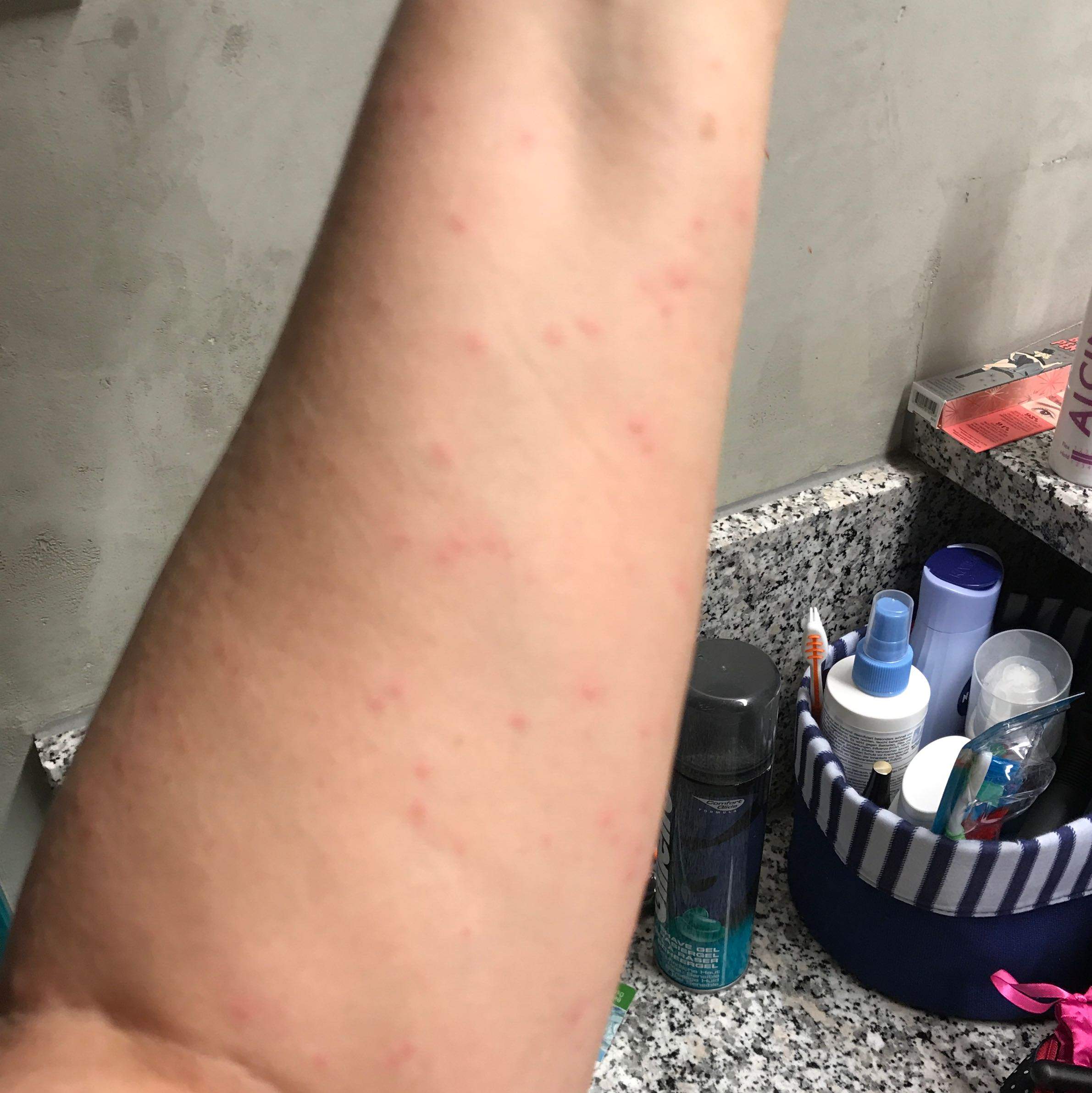 Plötzlich rote Pickel an Armen und Beinen im Urlaub (Österreich)? (Gesundheit und Medizin