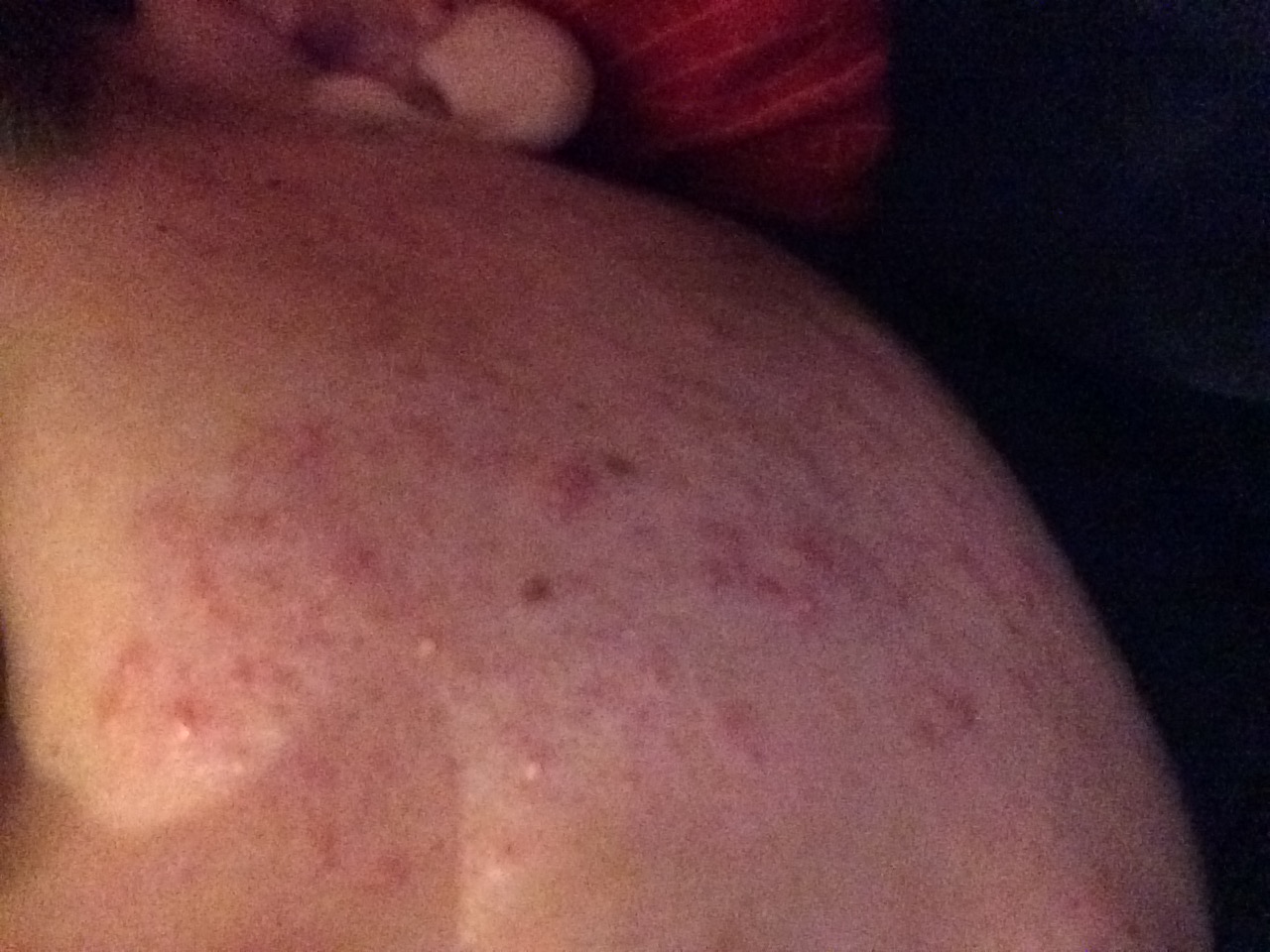 Stress Pickel Was Tun AA0