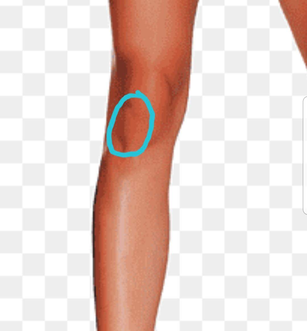 Beule Plötzliche Beule am rechten Knie? (Gesundheit und Medizin)