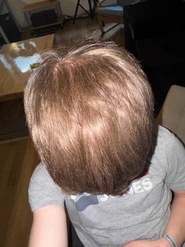 Plötzlicher Haarausfall M16? (Haare, Aussehen, Haarpflege)