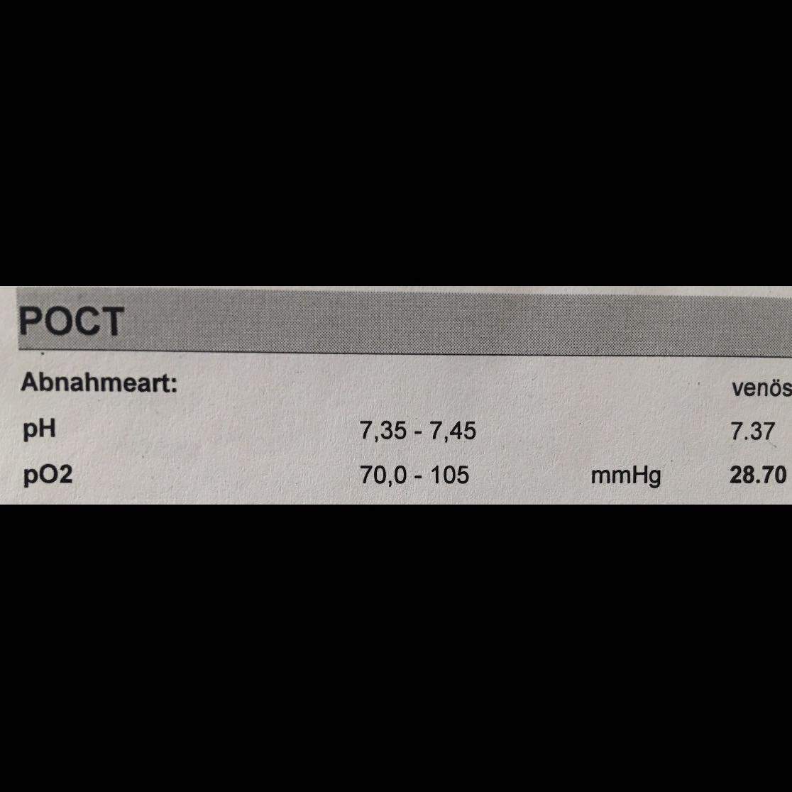Po2 Wert Zu Niedrig Gesundheit Und Medizin Medizin Arzt Po2 Wert Zu Niedrig Gesundheit Und Medizin Medizin Arzt