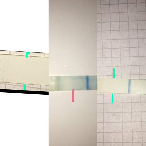 Positiv Es 8 Gesundheit Und Medizin Schwangerschaft Baby