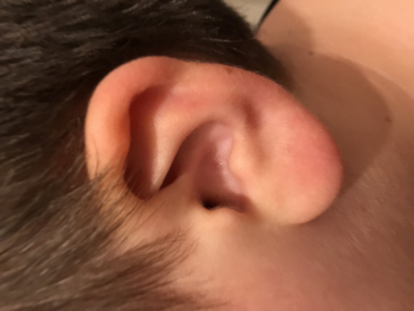 Problem Mit Ohren Kann Mann Da Sas Machen Airpods Problem Mit Ohren Kann Mann Da Sas Machen Airpods