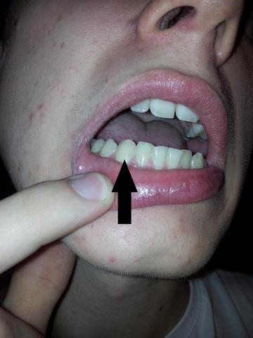 Der zahn - (Zähne, Zahnarzt, Mund)