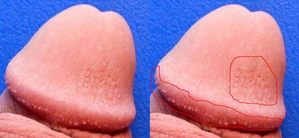 Probleme Im Genetalien Bereich Penis Pubertat Pickel Probleme Im Genetalien Bereich Penis Pubertat Pickel