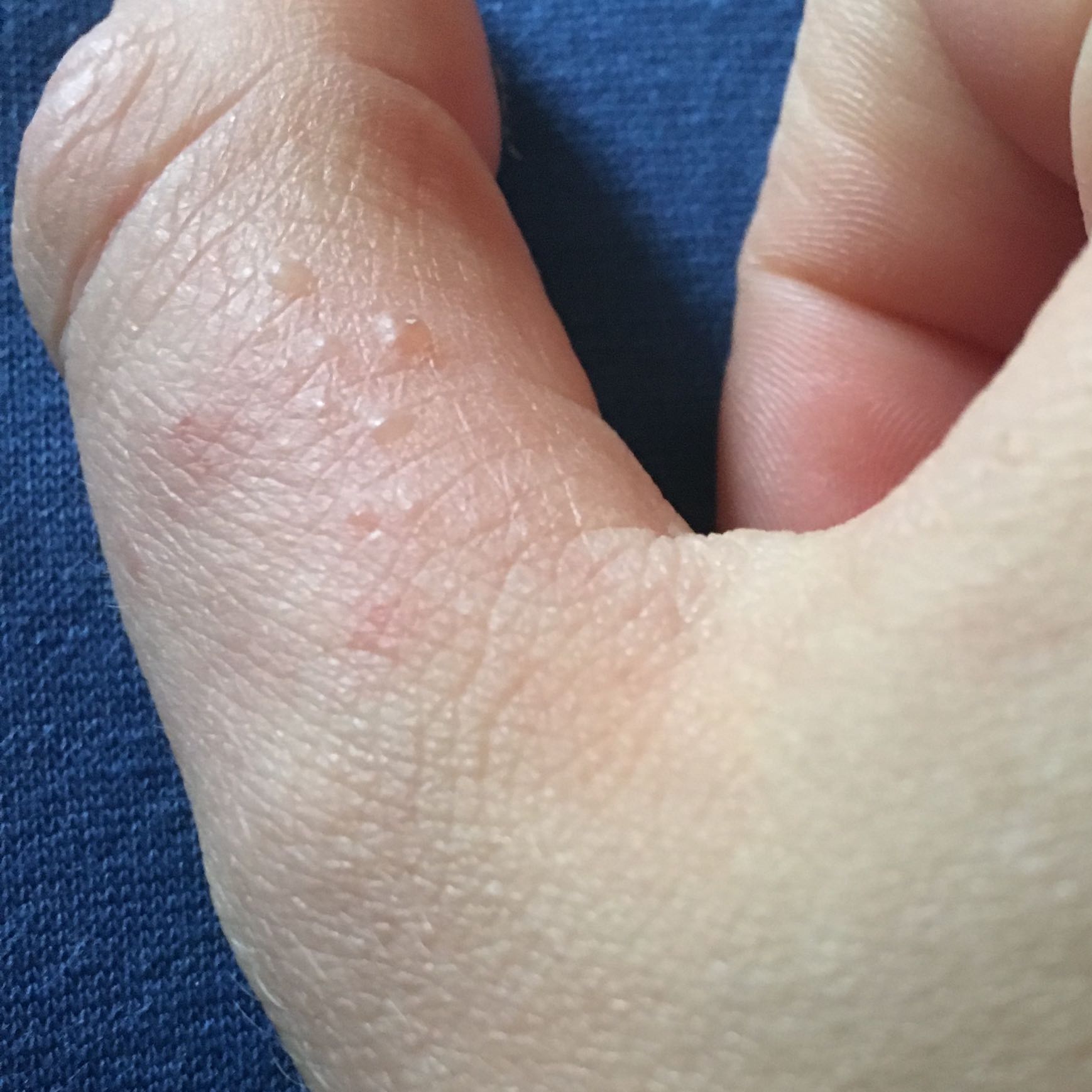 Probleme vom Pflaster? (Gesundheit, Arzt, Schmerzen) Probleme vom Pflaster? (Gesundheit, Arzt, Schmerzen)