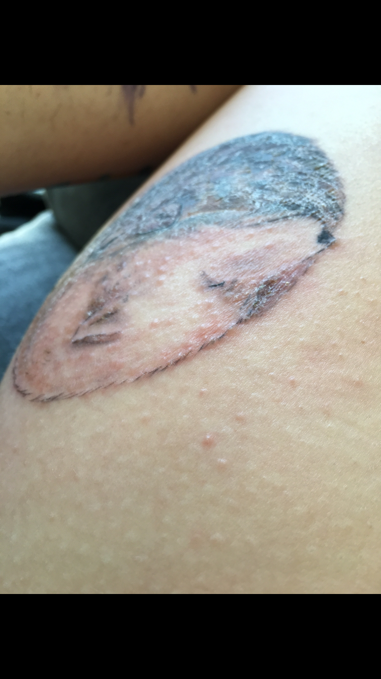 Psyche und Tattoo? (Gesundheit und Medizin)