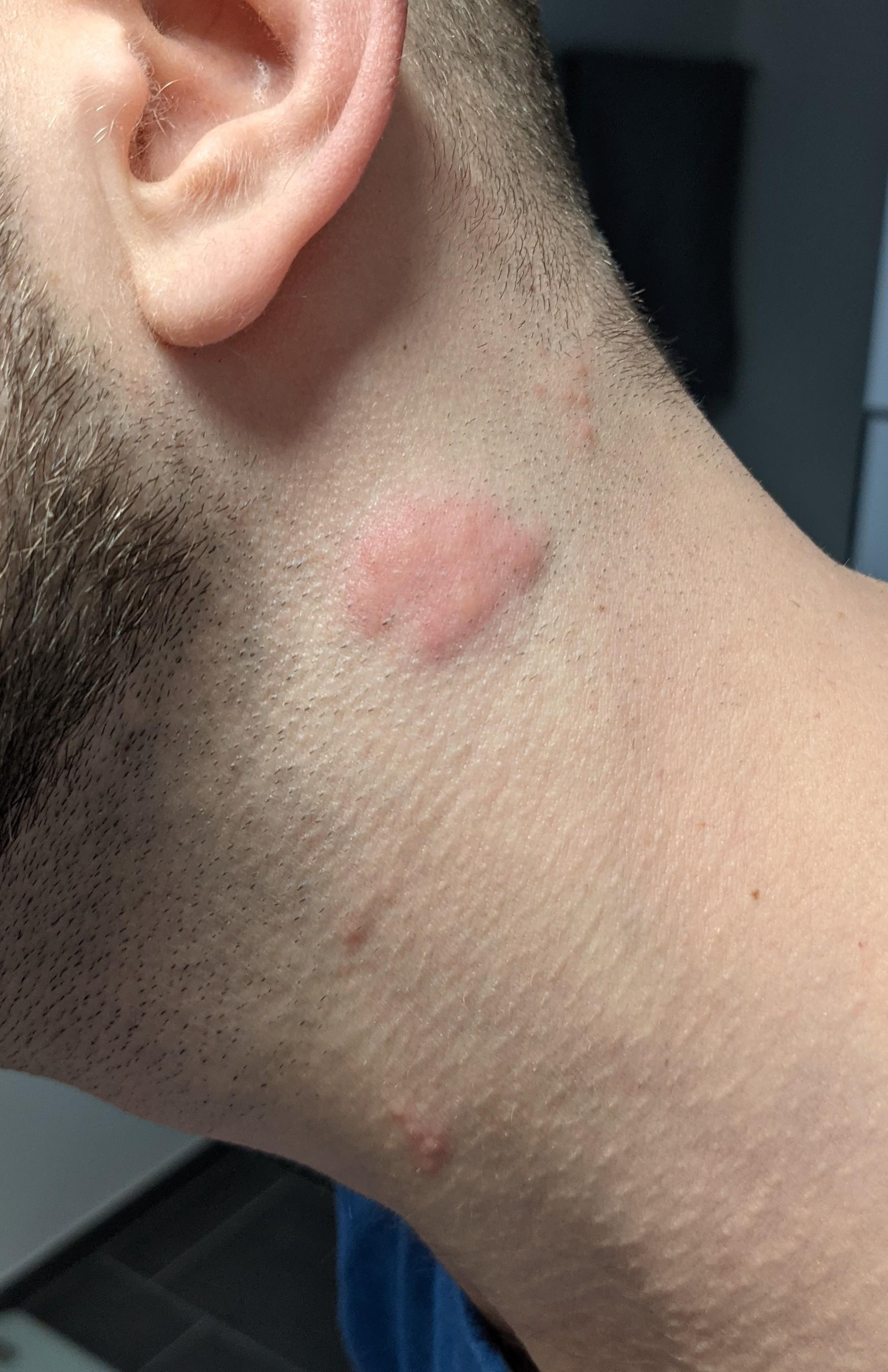 Knoten Hinterm Ohr Nicht Verschiebbar Knoten Hinterm Ohr Nicht Verschiebbar