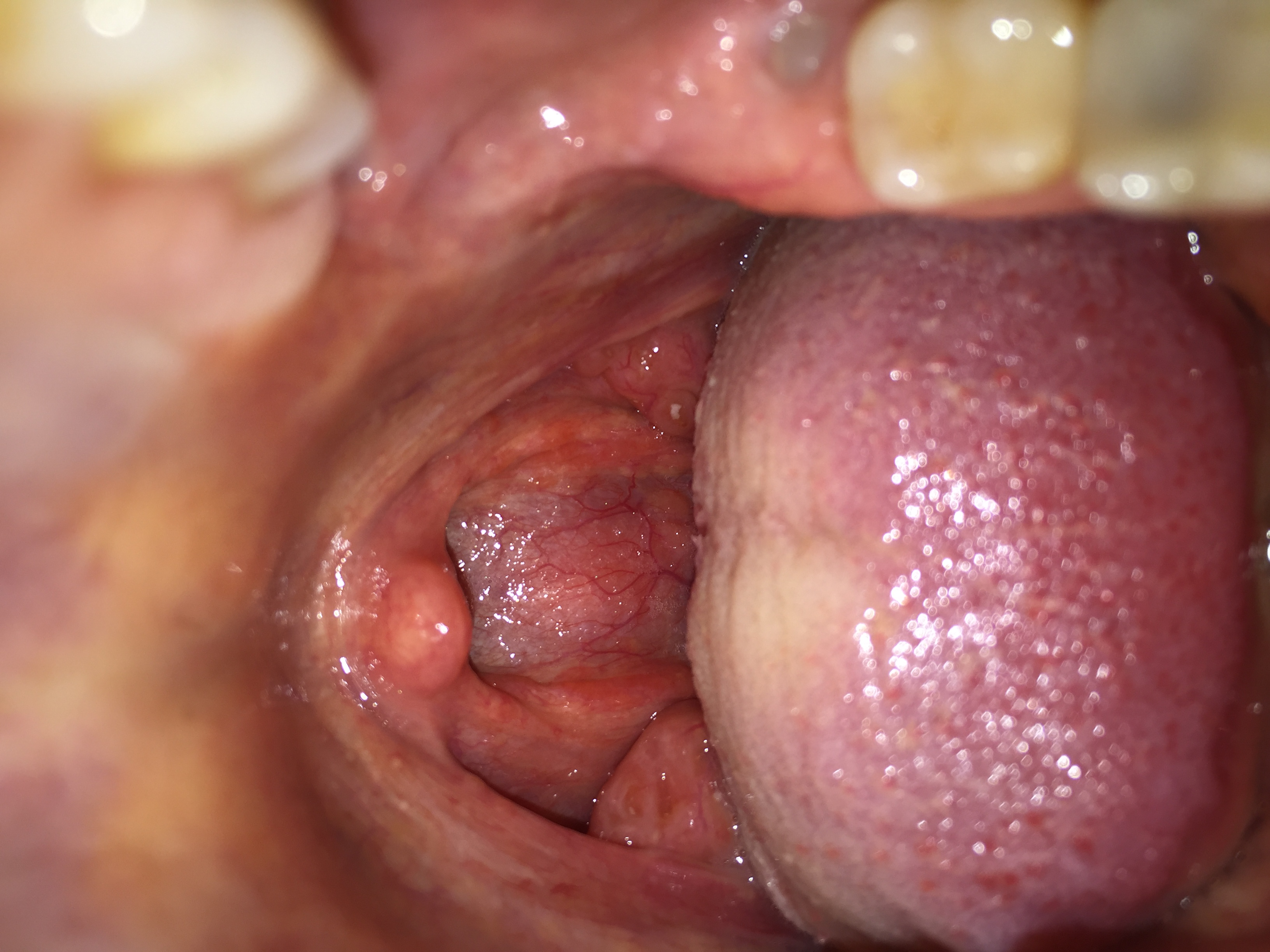 Rachen: was ist das? (Medizin)