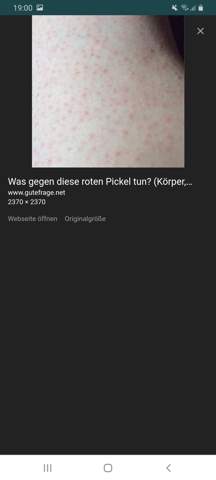 Rasier pickel Tipps? (Gesundheit und Medizin, Beauty, Haut)