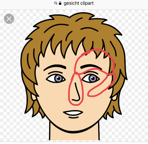 Rechte Gesichtshalfte Taub Kribbelt Gesundheit Und Medizin Gesundheit Arzt Rechte Gesichtshalfte Taub Kribbelt Gesundheit Und Medizin Gesundheit Arzt