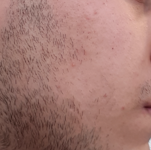 Reicht Dieser Bartwuchs Manner Bart