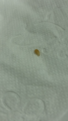 Reiskorner Im Stuhl Wurmer Im Darm Gesundheit Und Medizin Reiskorner Im Stuhl Wurmer Im Darm Gesundheit Und Medizin