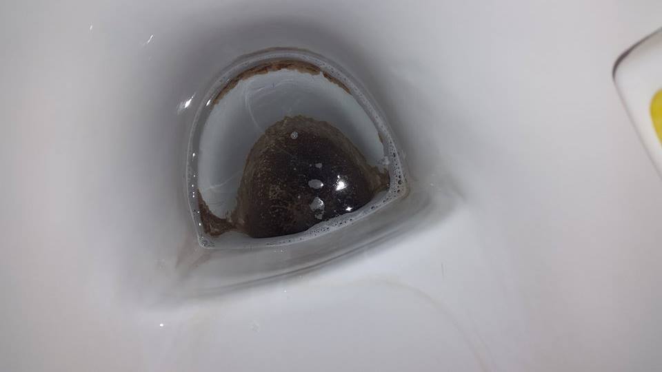 Richtig fieser Urinstein Toilette Richtig fieser Urinstein Toilette