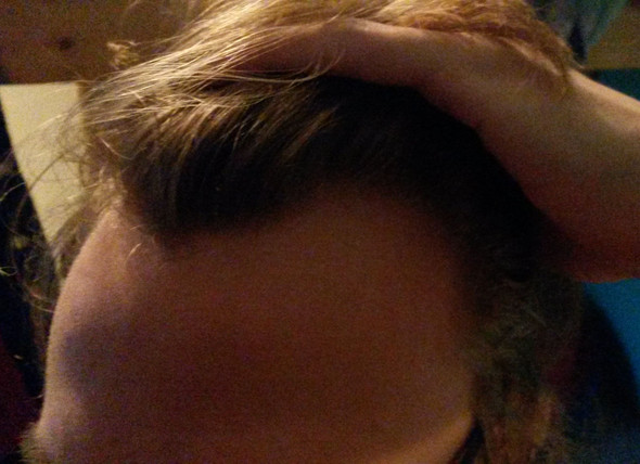 Riesen Geheimratsecken Mit 18 Welche Frisur Haare Jungs Mode