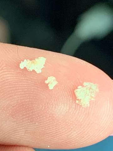 riesen schuppen was dagegen tun