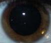 Pupillengröße bei Tageslicht - (Augen, groß, Pupille)