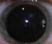 Pupillengröße ohne Tageslicht - (Augen, groß, Pupille)