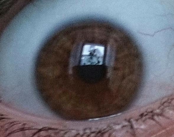 rechtes Auge  - (Augen, Ring, Iris)