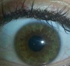 linkes Auge  - (Augen, Ring, Iris)