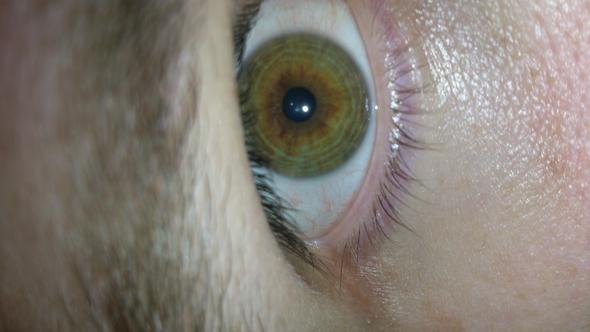 Ringe In Der Iris Medizin Ring Ringe In Der Iris Medizin Ring