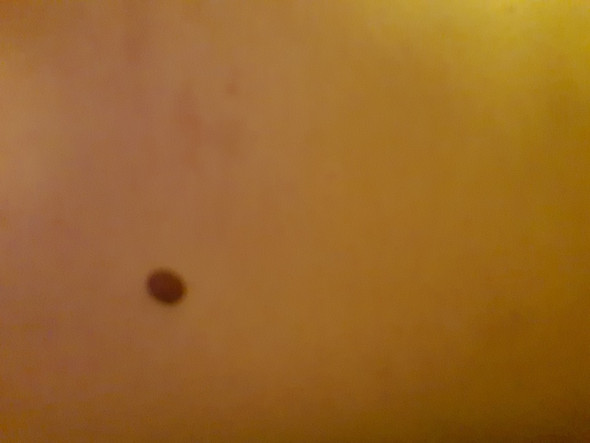 Ringelblumensalbe Heilt Muttermal Salbe Ringelblumensalbe Heilt Muttermal Salbe