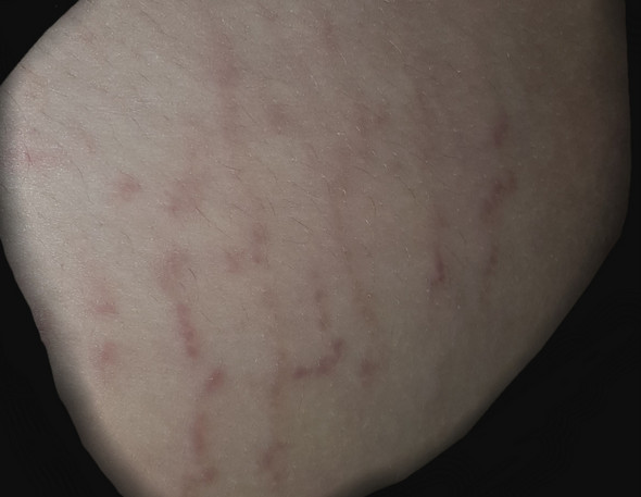 Risse An Beinen Gesundheit Und Medizin Beine Risse An Beinen Gesundheit Und Medizin Beine