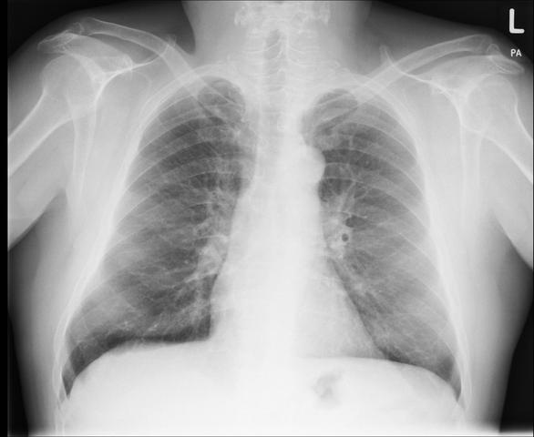 thorax - (Gesundheit, Körper, Bilder)