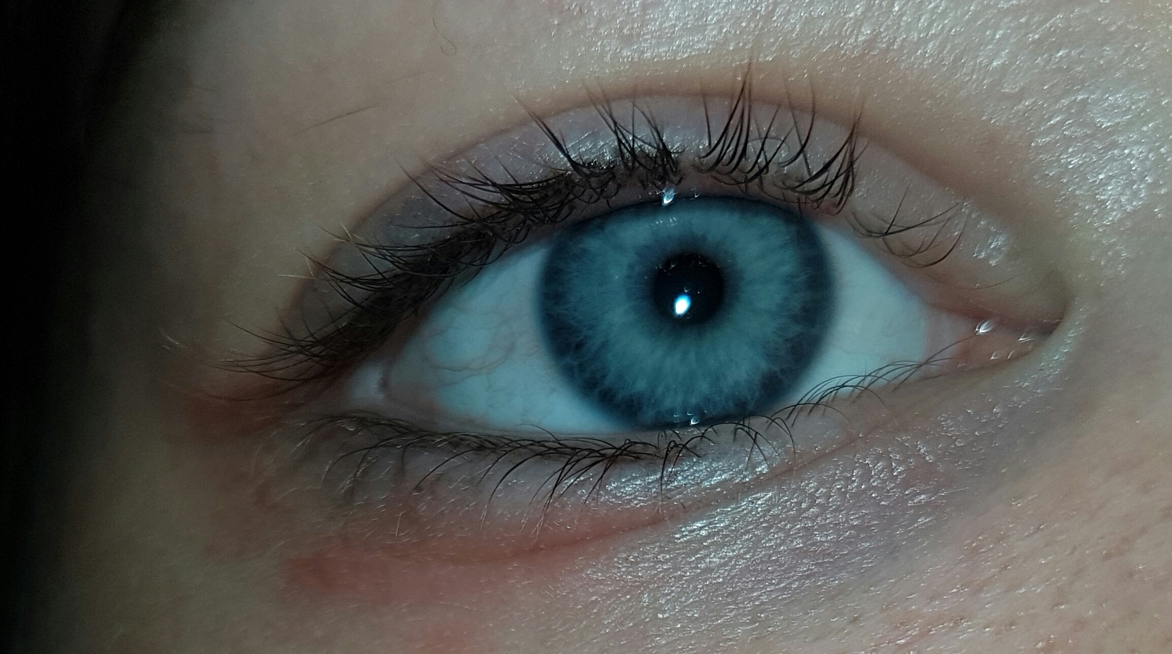 Rötung am Auge, geht das von alleine weg? (Arzt, Augen, Erkrankung)