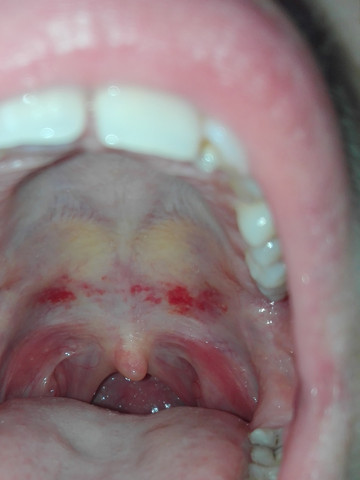 Gaumen Die Meistgelesenen Fragen Gaumen Die Meistgelesenen Fragen