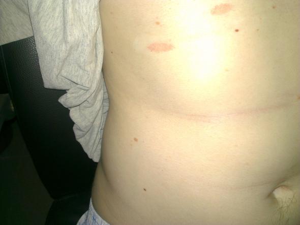 Rote Flecken Kein Juckreiz Was Konnte Das Sein Arzt Haut Pilze Rote Flecken Kein Juckreiz Was Konnte Das Sein Arzt Haut Pilze