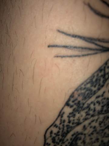 Rote Flecken Auf Tattoo Nach Ca 1 5 Wochen Nach Den Stechen Gesundheit Und Medizin Tattoopflege